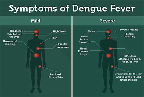 dengue hemorrhagic fever symptoms